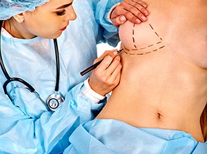 art_korrekcija_formy_i_razmera_areoly_i_soska_cont